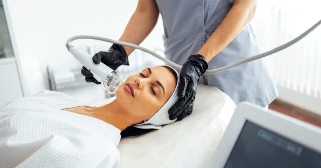 Microneedling Radiofrequency