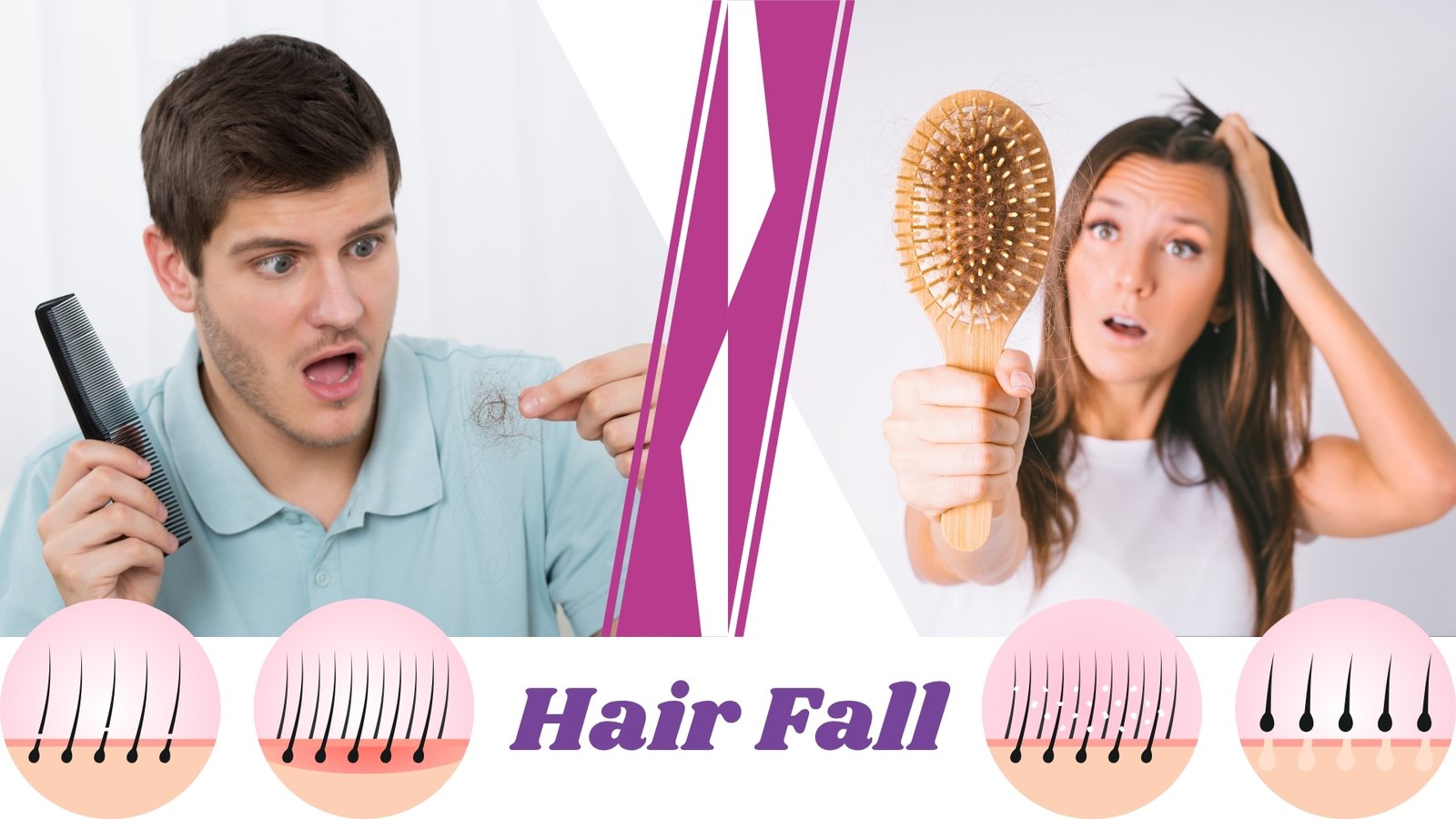 Hairfall