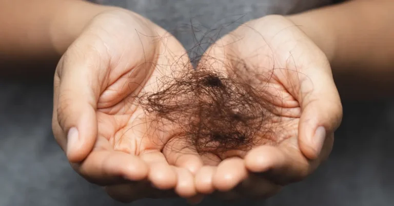 teen hair thinning Bangalore