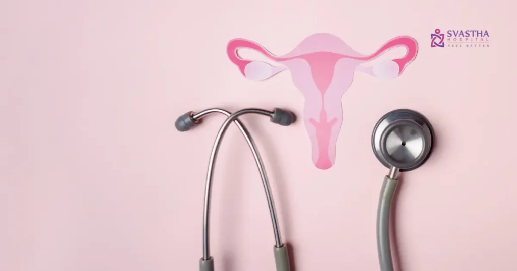 PCOS