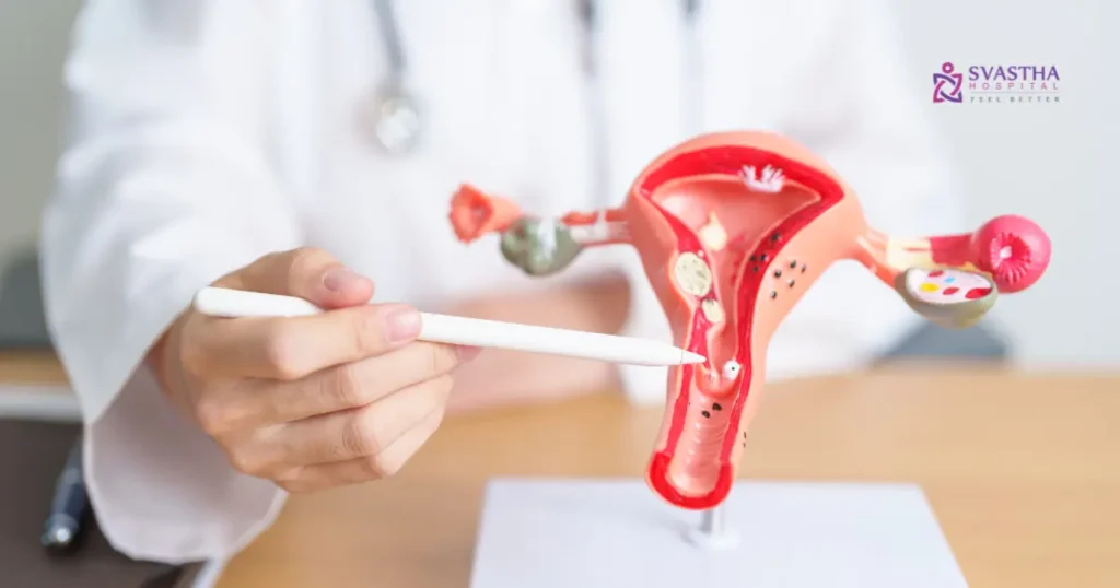 fibroids