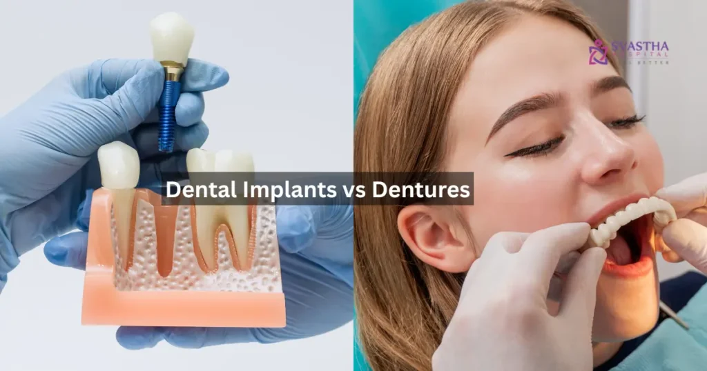 dental implants vs dentures